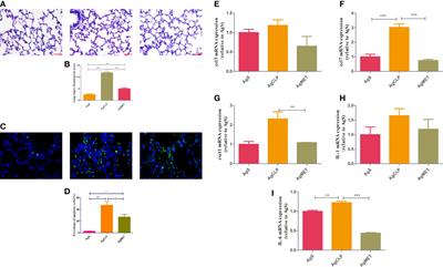 Effect of metformin on sepsis-associated acute lung injury and gut microbiota in aged rats with sepsis